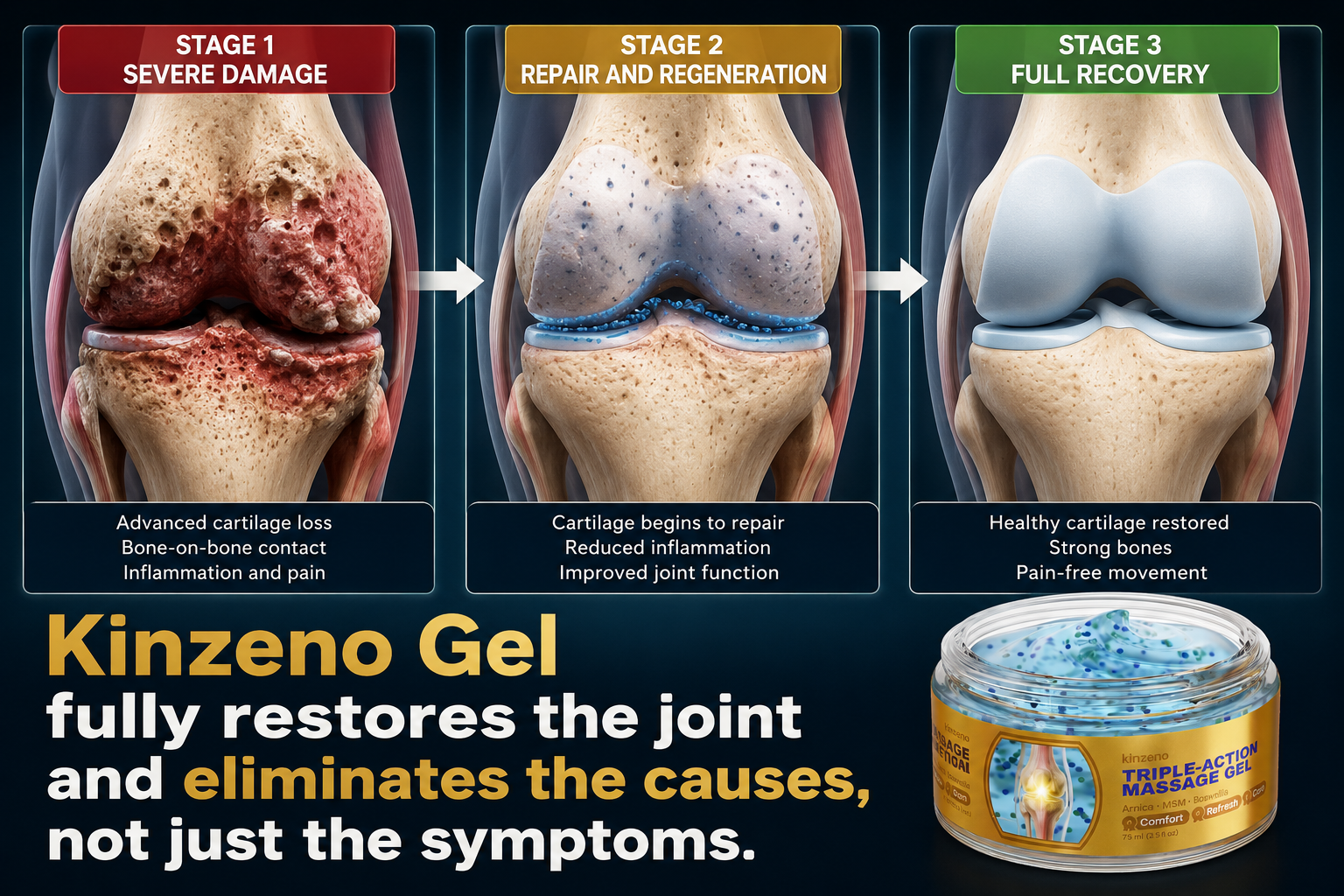 Joint Inflammation